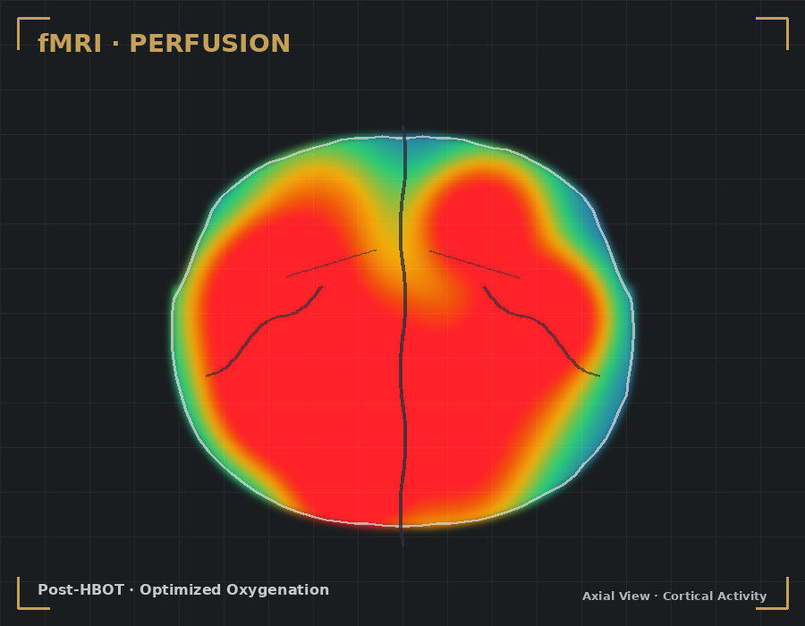 Post-HBOT fMRI perfusion map showing optimized cortical oxygenation across prefrontal, parietal and occipital regions